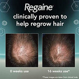 Regaine For Men Hair Regrowth Foam 3 x 73ml Online Shopping Store