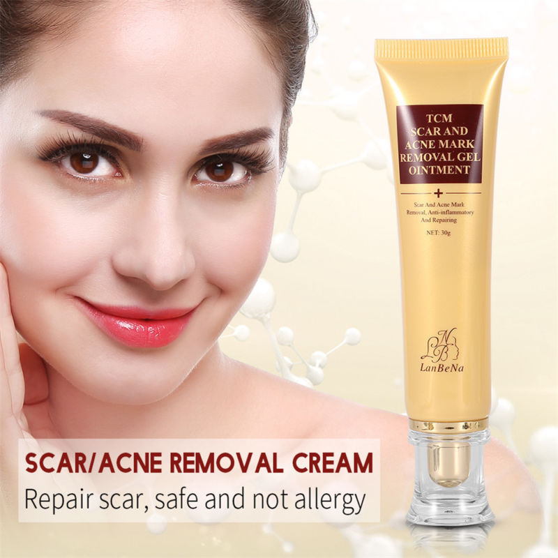 TCM SCAR AND ACNE MARK REMOVAL GEL OINTMENT Online Shopping Store
