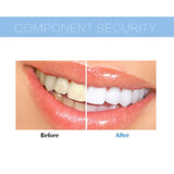 White Light Teeth Whitening Kit Online Shopping Store